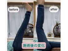 シオ 横浜関内(sio)/施術後の変化BeforeAfter
