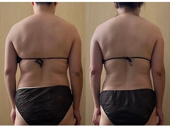 ココア(CoCoa)/活性リンパ洗浄