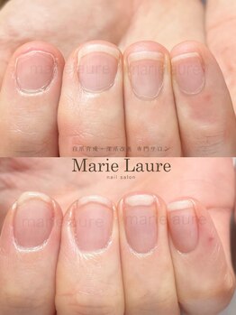 マリーロール 梅田店(Marie Laure)/自爪育成/深爪改善/ネイルケア