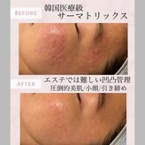 プレジール(Plaisir)