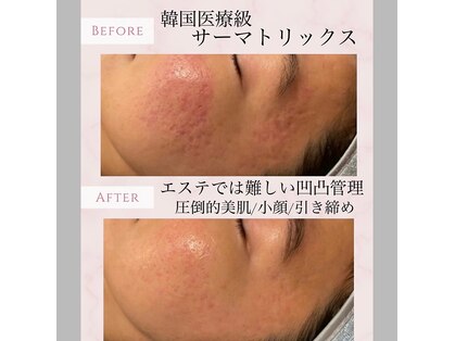 プレジール(Plaisir)の写真