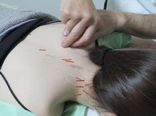 ヤマザキ治療院