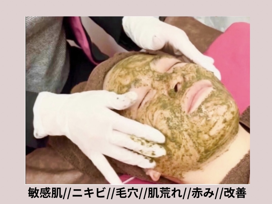 サロン ド シェリーの写真/【お肌の救世主★オーダーメイド式ハーブピーリング】繰り返しニキビ//毛穴//凸凹肌にお悩み方にお勧めです