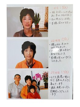 てんゆう整体/長年苦しんだ肌トラブルの回復