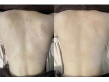 エト(eto.)の雰囲気（男性のお客様も大歓迎◎ハーブピーリング ）