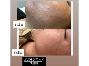 ラヴィエール(Laviere)/VOS BLACK