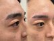 ルモア(Lumor)の写真/札幌大通で叶えるメンズの美！丁寧なカウンセリングと似合わせデザインで垢抜けへ◎