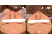 アネル 浦添店(anel)/