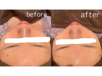 アネル 浦添店(anel)/