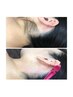 6月【大人気クーポン】光脱毛＋Wax脱毛！早い綺麗満足度◎美しいうなじへ★