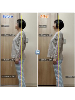 立川カイロプラクティック/矯正☆Before-After☆