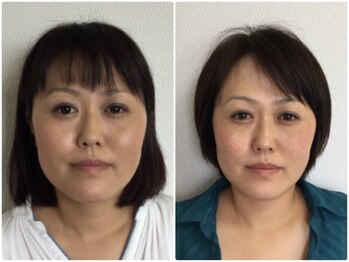 美容整体ウェリナ 名駅院/小顔矯正/骨盤矯正/美脚サロン