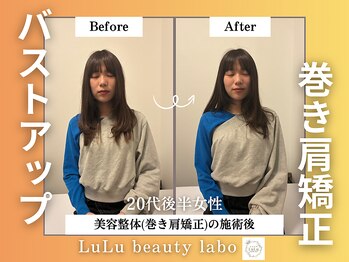 ルルラボ(LuLu beauty labo)/美人が更に姿勢美人に!!