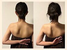 ラフリー 武蔵小杉院(RUFFREE)/自律神経の調整にも肩甲骨はがし
