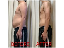 にしやま整骨院の雰囲気（まずはカウンセリングから◎お客様のお悩みや理想をお伺いします）