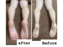 サロンドビジュー(salon de bijou)/ホットストーン×血行促進