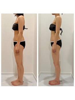 ヴィナーレ(VINARE)/自己流は事故流