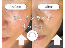 ユヌランコント 岐阜店(Une rencontre)/EMS×ラジオ波×エンビロン