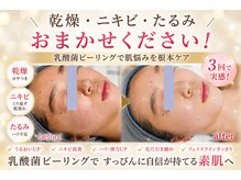 セレブリティ(Celebrity)の雰囲気（【肌悩み別に選べるクリスティーナ】）