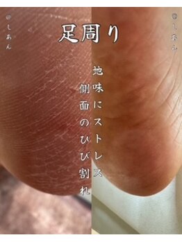 しあん 京都の写真/自己ケアでは改善しにくいガサガサかかとも、プロの角質ケアでつるつる素足へ導きます。