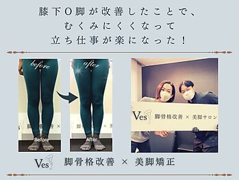 ビース(Ves)/お客様のご感想