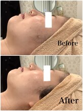 スペチアーレ 夙川/直後から引き上がりを実感