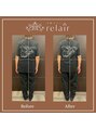 リレア(relair) 1度の施術でも差がしっかりと感じられました!