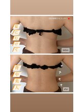 ソルーチェ(soluce)/夏にむけて綺麗なラインを♪