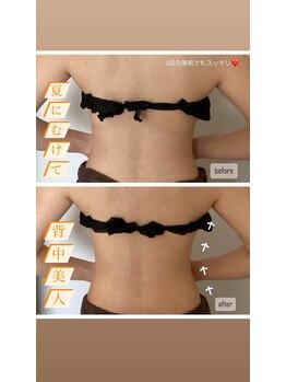 ソルーチェ(soluce)/夏にむけて綺麗なラインを♪