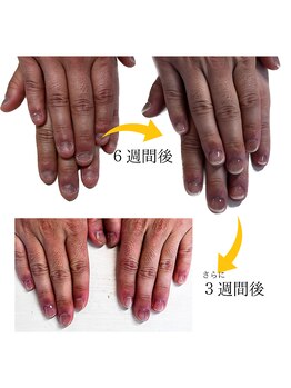 ヴェールリム(verl lim)/