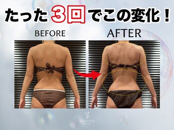 ヴァリエス プライム 中目黒店(VARIES PRIME)