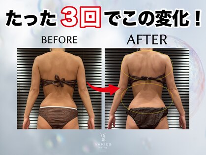 ヴァリエス プライム 中目黒店(VARIES PRIME)の写真