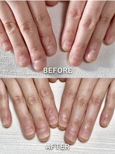 ポメロ(POMELO)/看護師、介護職でも大丈夫！