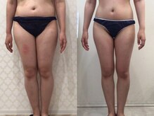 ビラ 銀座店(BILA)/キャビラジ