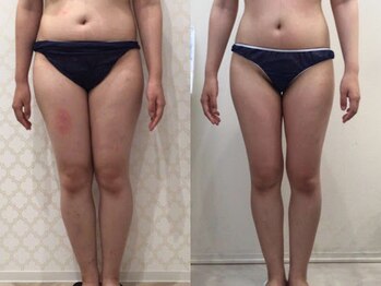 ビラ 銀座店(BILA)/キャビラジ