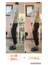 スマイル(smile)/before after 