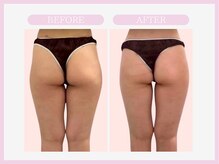 スリムライン 盛岡店(The Slim Line)/before→after