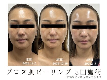 エクシア(ECXIA)の写真