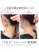 ミース 長野店/うなじ矯正◆ビフォーアフター