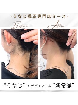 ミース 長野店/うなじ矯正◆ビフォーアフター