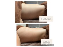 ミューク(mjuk.)の雰囲気（【腸もみ】だるさ、肌荒れ、便秘、ストレスの緩和に☆）