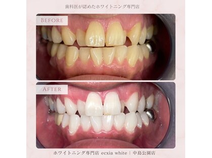 エクシアホワイトニング 札幌琴似店の写真