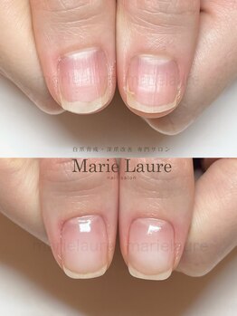 マリーロール 梅田店(Marie Laure)/深爪改善/自爪育成/ネイルケア/