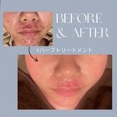 ニキビケア研究所 笹塚店