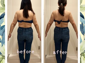 ヨサパーク ハーブ ラキ 鳴海店(YOSA PARK herb *Laki)/緑区/ダイエット/痩身/肩こり