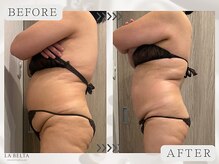 エステティックサロン ラ ベルタ(Esthetic Salon La Belta)/美骨ケア+セルライトゼロ3回