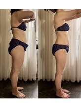 サロン ド プリヴェ(Salon de PRIVE)/50代フォルム形成集中12回プラン