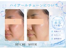 ユアーズ ビューティー(YOURS beauty)/内側から輝くうるツヤ水光肌へ