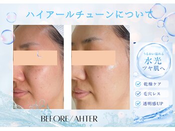 ユアーズ ビューティー(YOURS beauty)/内側から輝くうるツヤ水光肌へ