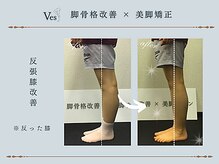 ビース(Ves)/綺麗なラインの脚へ